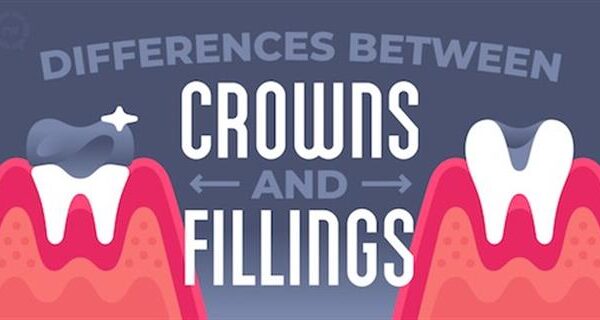 Dental Crown vs. Filling: Which One Is Right for You?