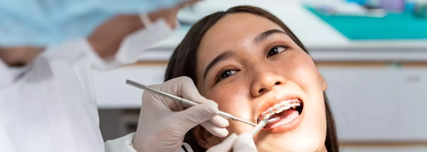 How Long Does It Take to Get Braces? Full Timeline Explained