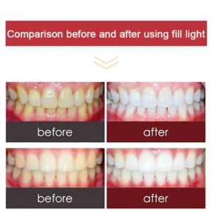 Dental Photography Flash Light Kit – 2-in-1 LED Oral and Mobile Fill Light for Dentists - Image 3