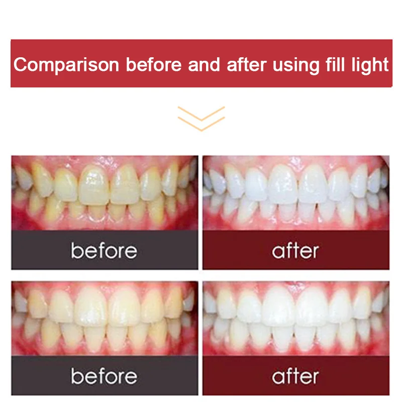 Dental Photography Flash Light Kit – 2-in-1 LED Oral and Mobile Fill Light for Dentists - Image 3