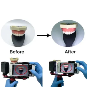 Dental Photography Flash Light Kit – 2-in-1 LED Oral and Mobile Fill Light for Dentists - Image 17