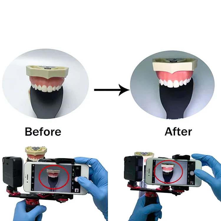 Dental Photography Flash Light Kit – 2-in-1 LED Oral and Mobile Fill Light for Dentists - Image 17