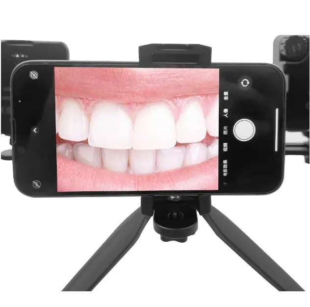 Dental Photography Flash Light Kit – 2-in-1 LED Oral and Mobile Fill Light for Dentists - Image 8