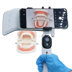 Dental Photography Flash Light – Best Flash for Dental & Mobile Photography - Image 11