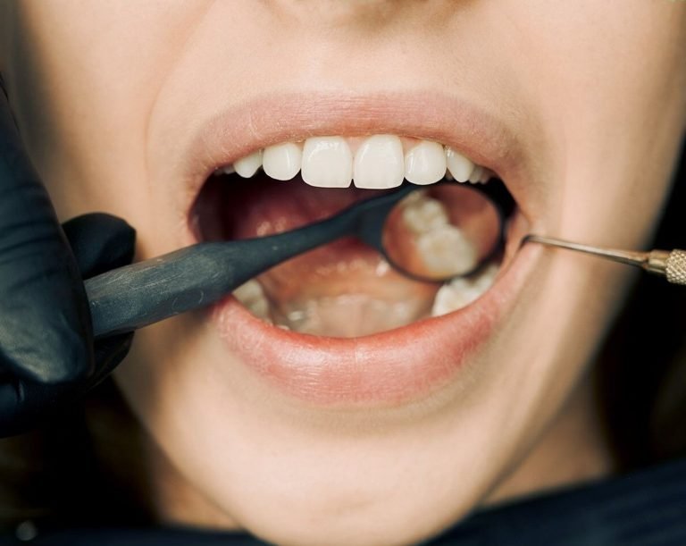 How to Protect Your Oral Health